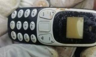 هاتف
      فى
      معدة
      مريض
      منذ
      عامين..
      واقعة
      طبية
      نادرة
      بمستشفى
      الأزهر
      في
      أسيوط