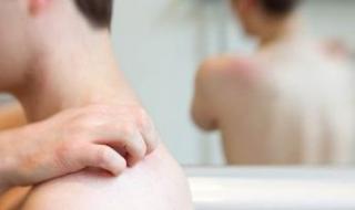 فاكسيرا
      تكشف
      طريقة
      علاج
      الإصابة
      بالحزام
      النارى..
      اعرف
      التفاصيل