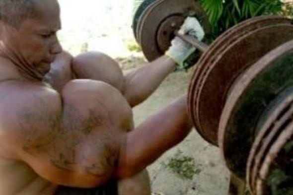 وفاة
      باباى
      البرازيلى
      صاحب
      أكبر
      عضلات
      ذراع
      بسبب
      حقن
      الزيوت..
      اعرف
      التفاصيل